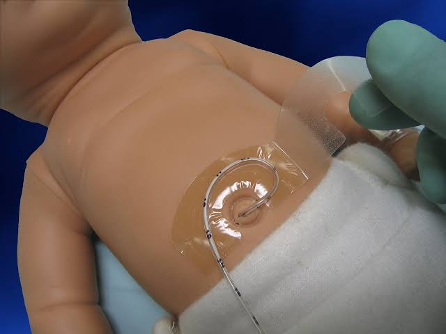 Soporte para Catéter y Tubo Umbilical Hold-A-Line Estándar N705 - Neotech Caja x40