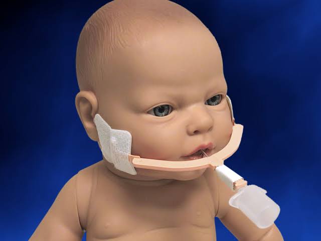 Sujetador de Tubo Endotraqueal NeoBar Jumbo Gris N716H - Neotech Caja x5